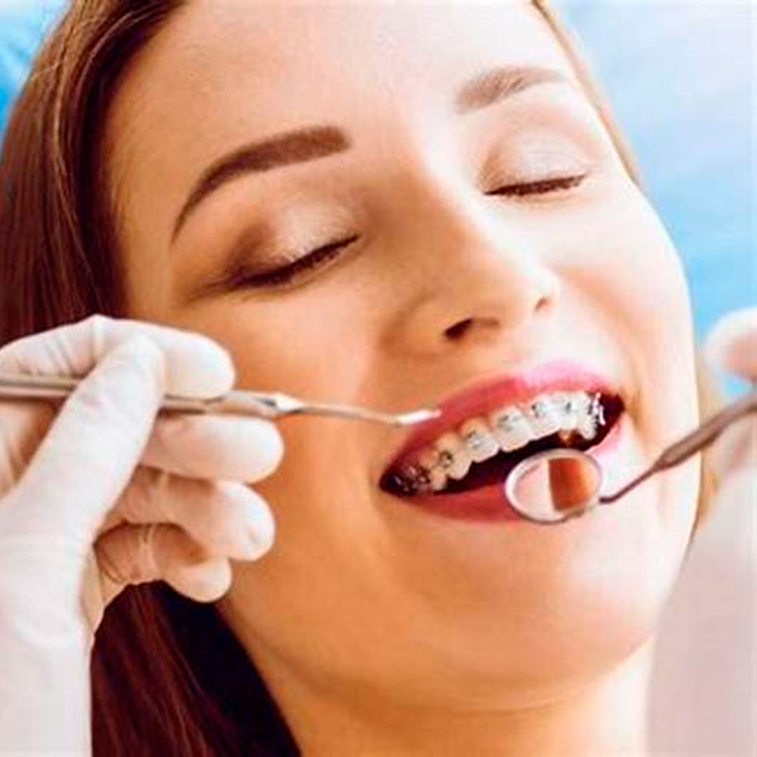 implante dental en Valls Clínica Dental