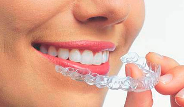 implante dentales en Valls Clínica Dental