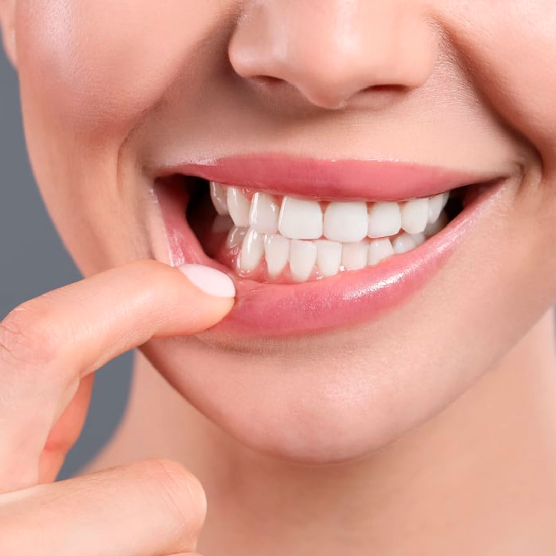 periodoncia en Valls Clínica Dental Valls gingivitis periodontitis tratamientos