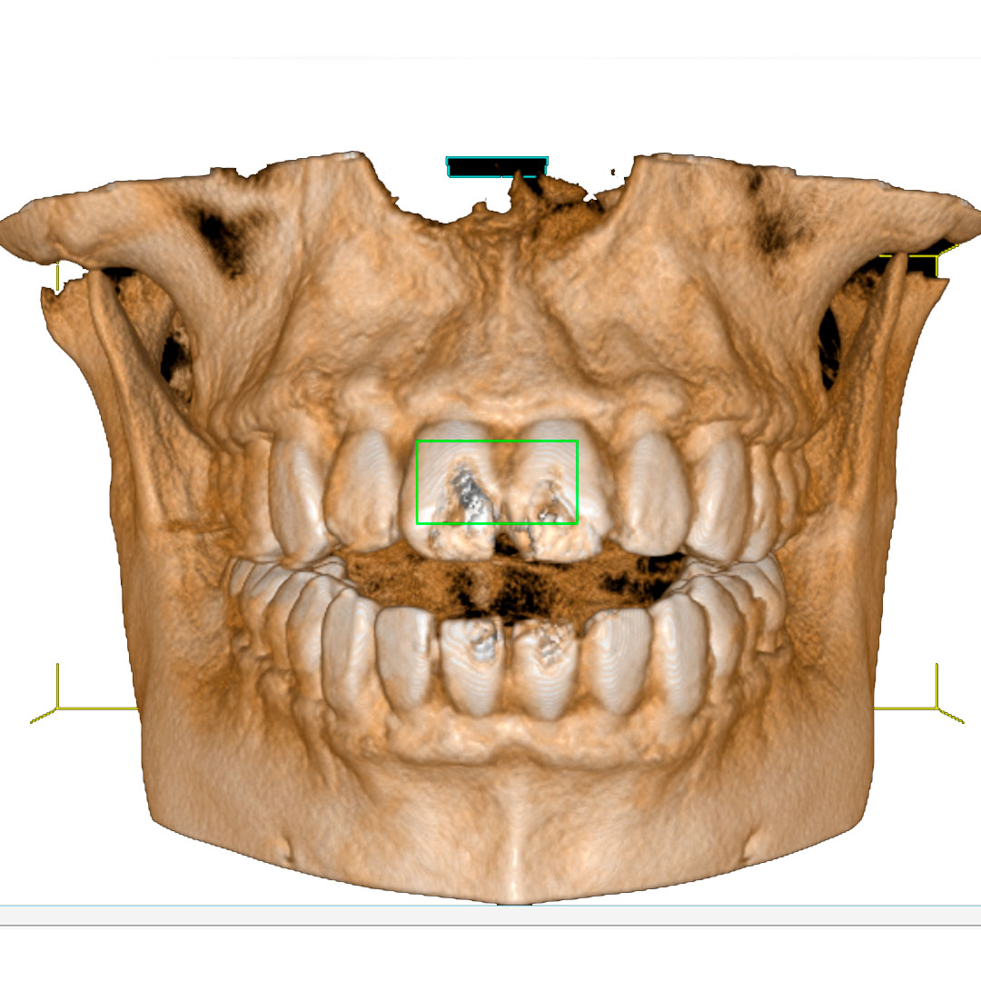 radiologia dental en Valls