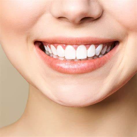 estética dental valls blanqueamiento dental
