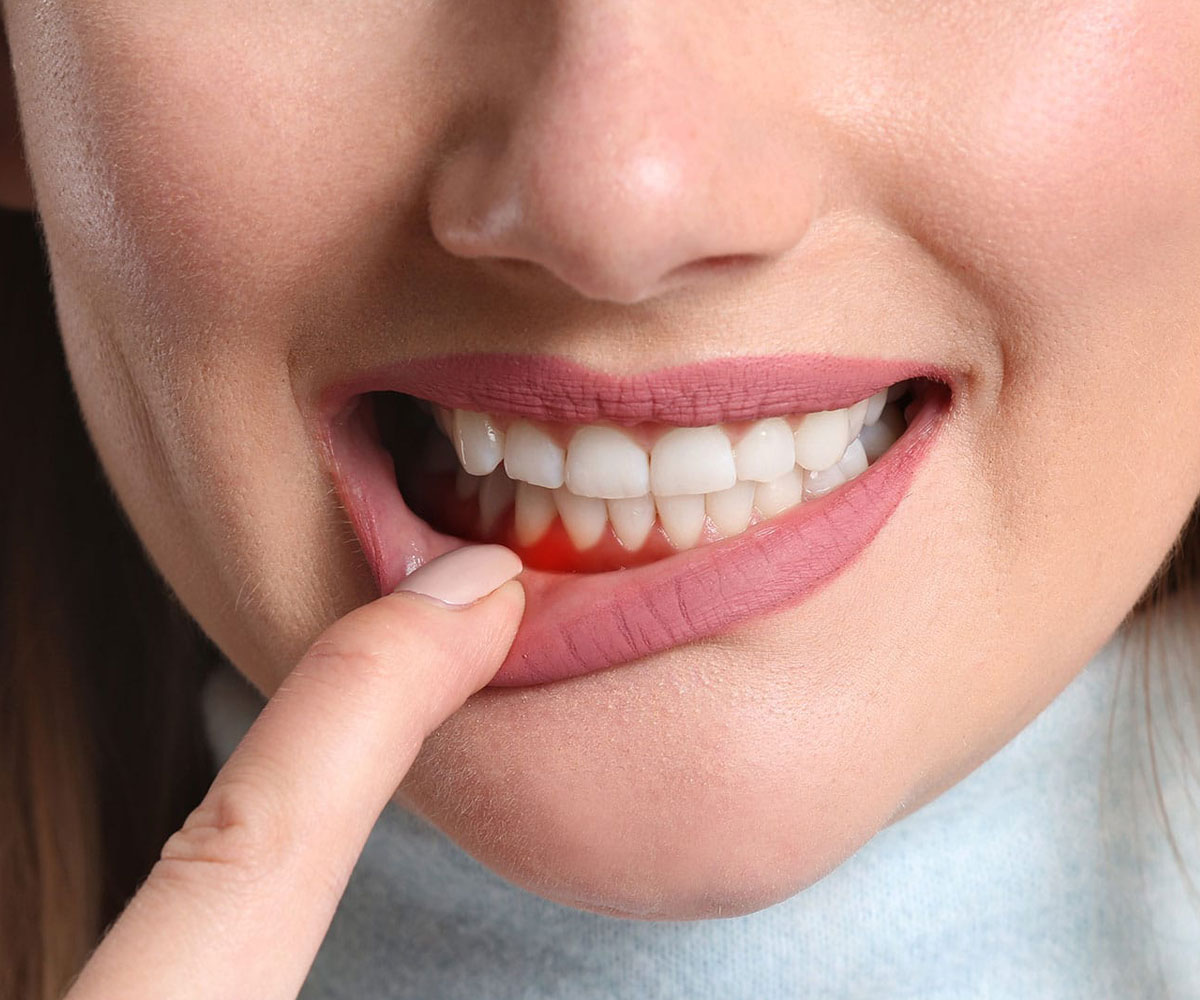 periodoncia tratamientos estética Dental Valls