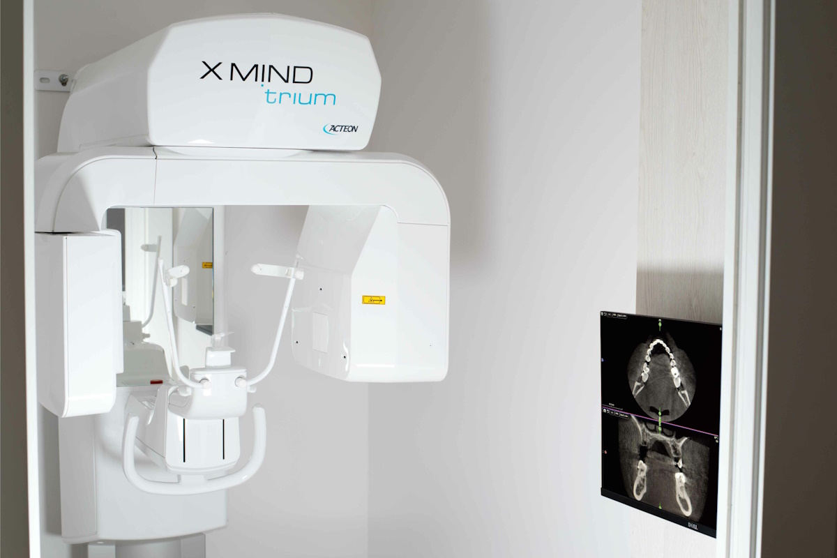 Vista 3D de mandíbula obtenida por TAC dental en Valls