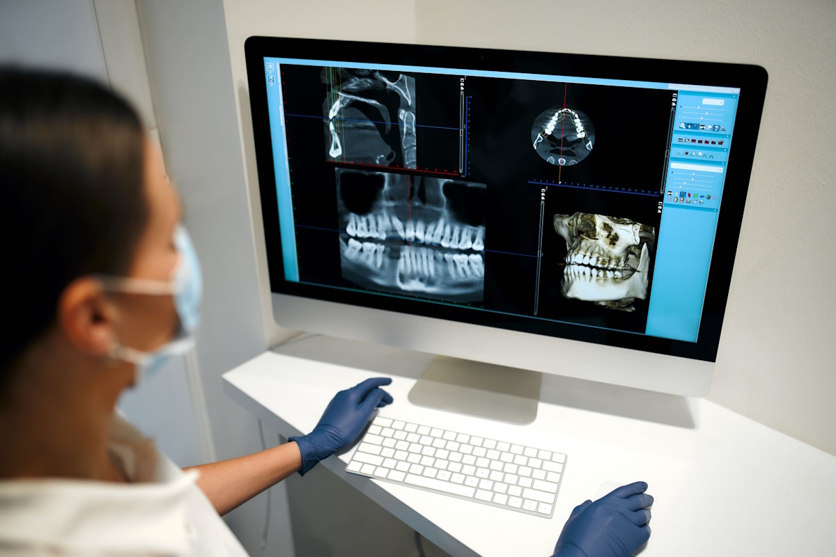 Interpretación de resultados del TAC dental en Valls por odontólogo