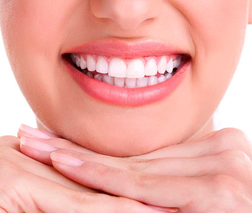 blanqueamiento dental clínica Dental Valls