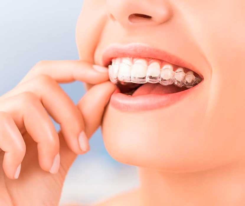 Ortodoncia clínica Dental Valls