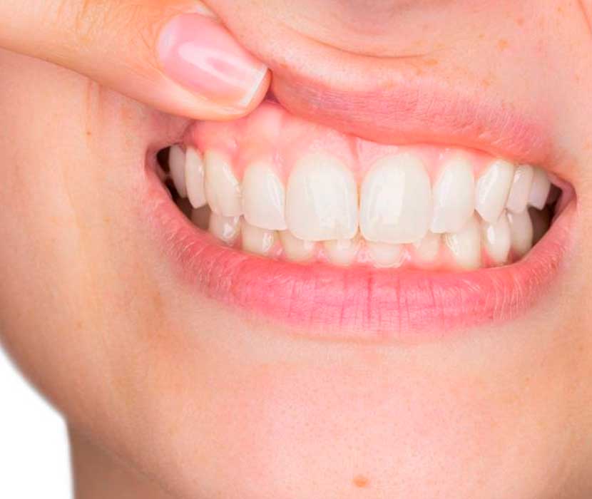 Periodoncia valls