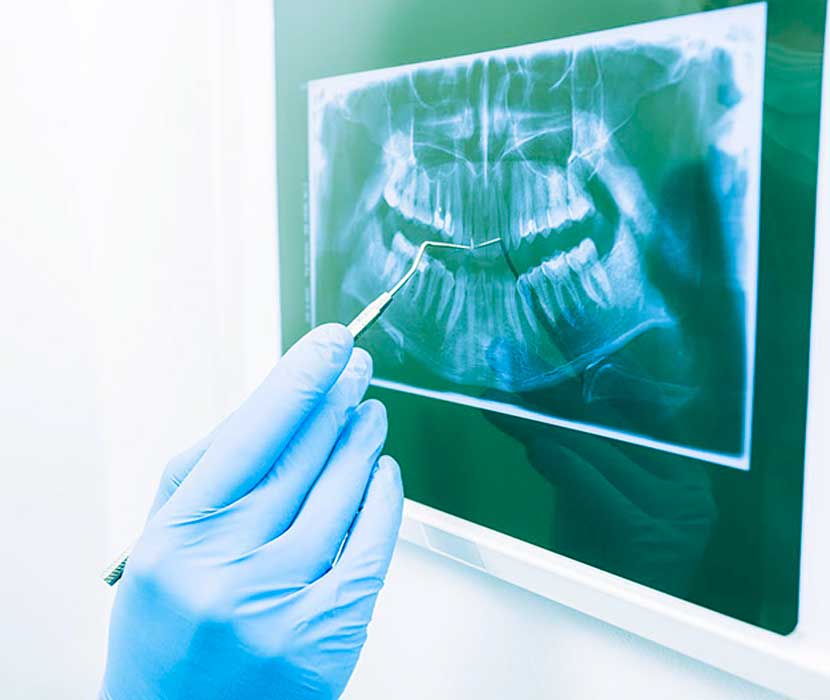 Radiología en Valls Tac dental